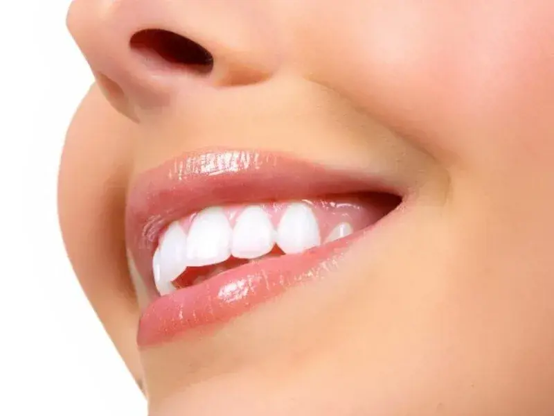 GUMMY SMILE
