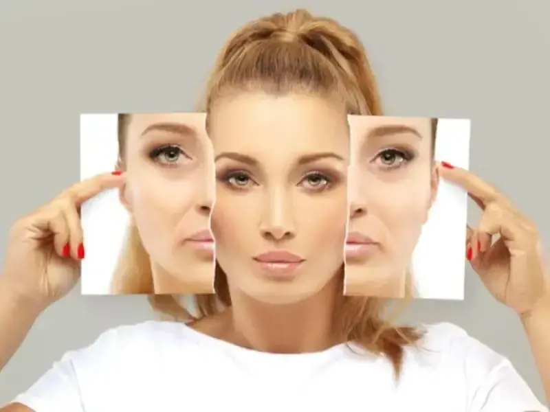 BOTOX BEHANDLUNG